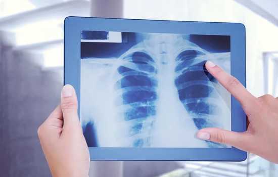 Apps para Usar Raio X no Celular