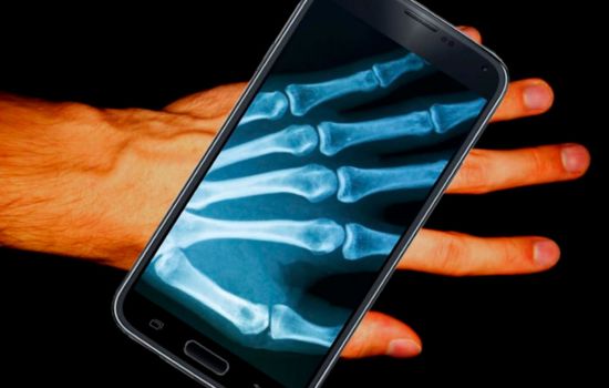 App de Raio-X no Celular