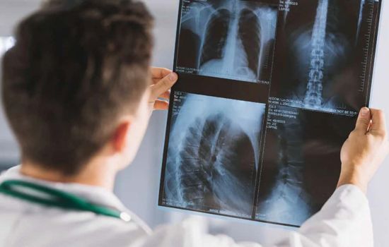 Realizando Raios-X no Seu Celular com Aplicativos