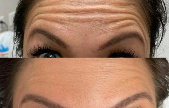 Suavize Sua Imagem: O App "Removedor de Defeito de Rosto"